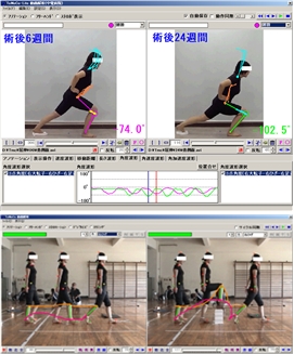 動画解析